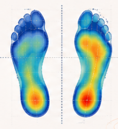 Plantar pressure heatmap