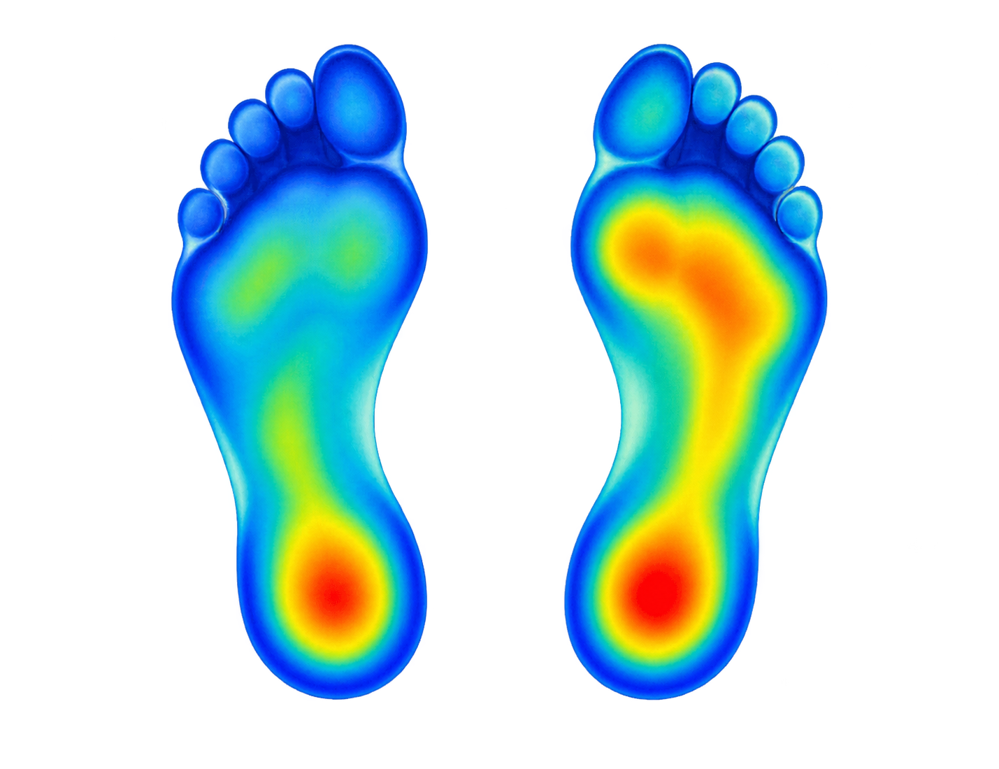 Plantar pressure heatmap